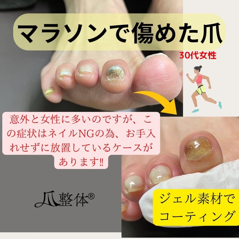 ビフォーアフター事例