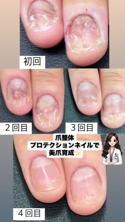 ビフォーアフター事例