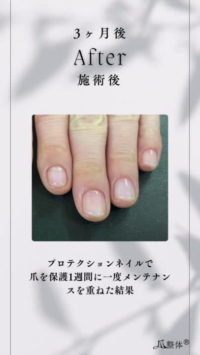 ビフォーアフター事例