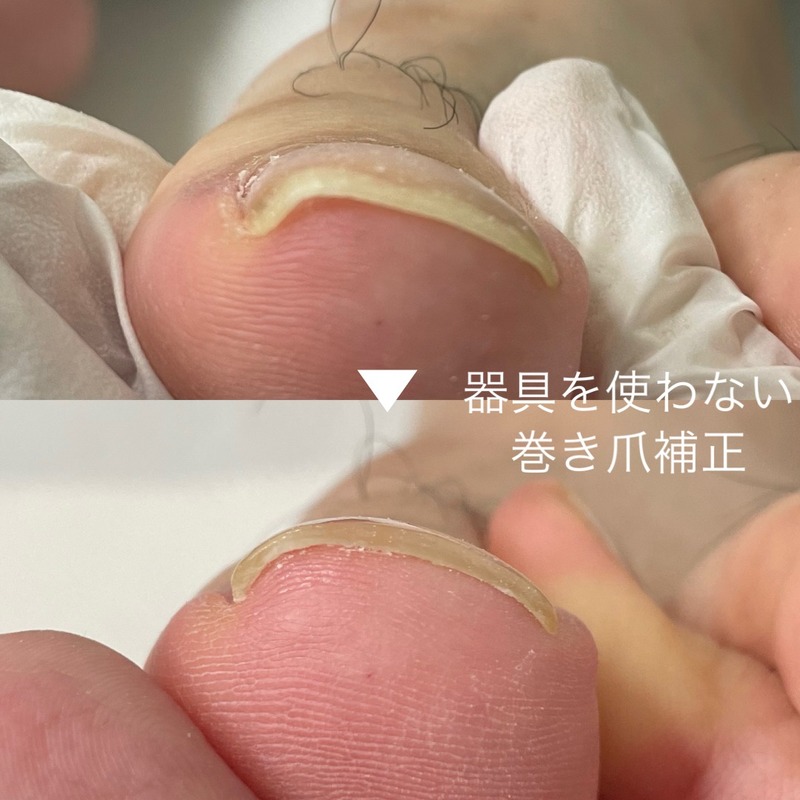 ビフォーアフター事例