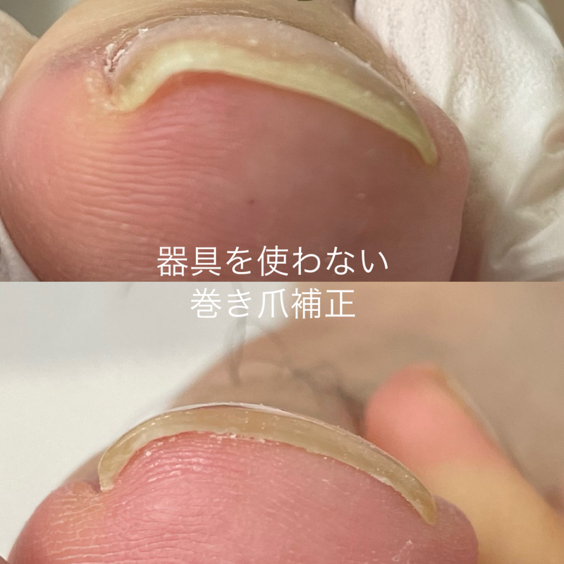 ビフォーアフター事例